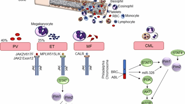 Targeting Pim kinases in hematological cancers